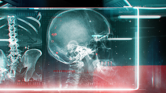 watch x-ray shark sk...