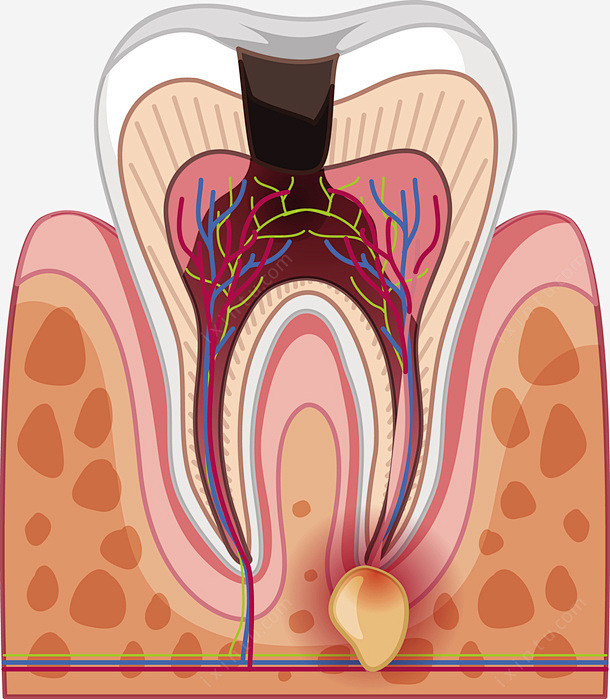 矢量牙齿结构下载免抠png素材_新图网i...