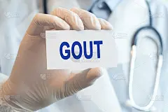 医生拿着一张纸卡，上面写着痛风，医学概念