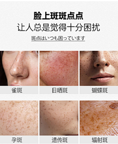 gln猴儿采集到皮肤衰老