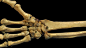 Human Hand, Bones, Arm