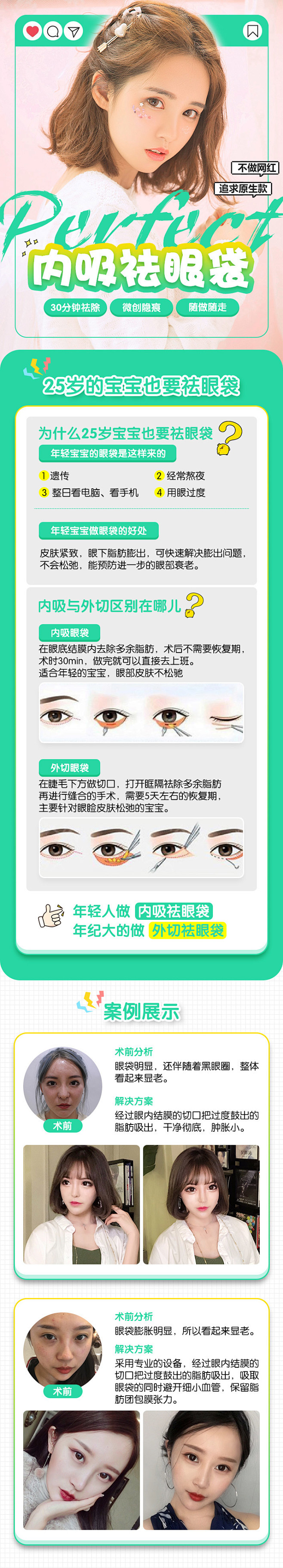 内吸祛眼袋1