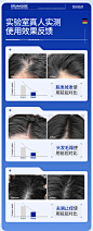 毛囊炎洗发水二硫化硒去屑止痒洗头露膏控油蓬松清洁官方品牌正品-tmall.com天猫