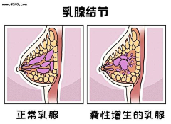 小阳、采集到A-乳腺