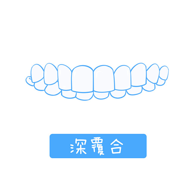 牙套 牙齿矫正 牙齿 口腔 舌侧隐形牙套 金属自锁牙套 传统陶瓷牙套 传统金属牙套 进口隐适美牙套 时代天使隐形牙套 金属自锁半隐形牙套 牙套 
