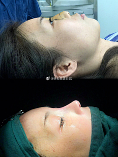 小眼睛单眼皮儿女生采集到案例