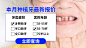 种牙头图banner入口图