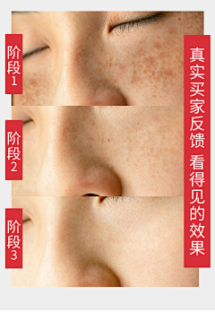 xianyyyyyy采集到斑
