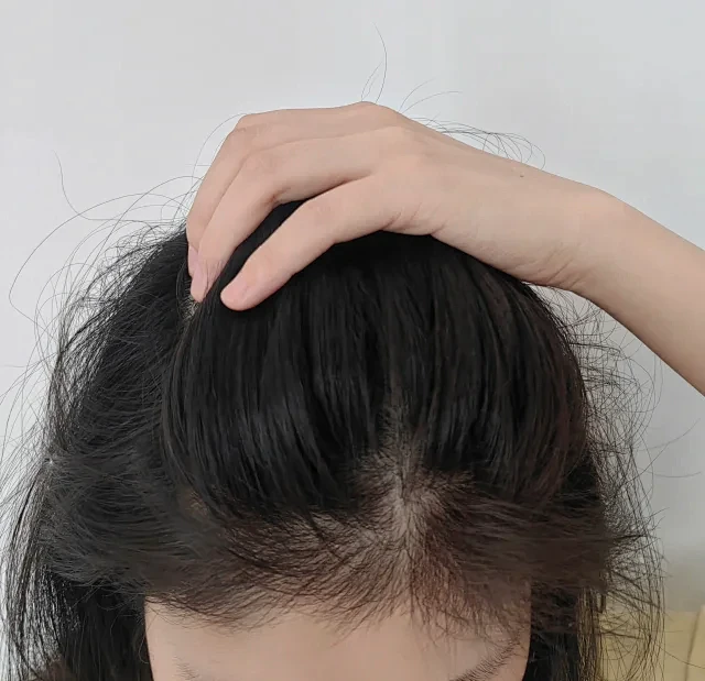 都去给我买！！！！！！！！（重度秃头）-花瓣网