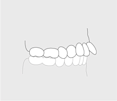 hnsylei采集到Tooth