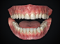 Teeth Asset, Fareed Nagy : I built a new and improved set of teeth that is now available for sale here on Artstation! Film and Real-time versions available separately. 

https://artstn.co/m/jKYd

https://artstn.co/m/oR6m


VFX Asset Includes:  
.FBX Mesh 