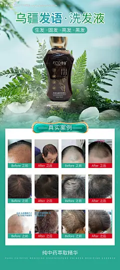 源文件下载【生发液案例海报】编号：81820016161842100