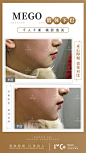 2800+医美整形案例视频-图片#美女模特#高清素材#打包下载