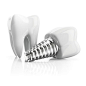 Tooth implant, illustration创意图片素材 - Science Photo Library