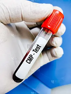 科学家手持血液样本进行CMP(综合代谢组)测试，化学组，肝功能，肾功能和营养水平