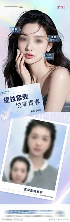 医美面部提拉紧致案例海报设计_源文件下载_PSD格式_1284X4034像素-小V脸,青春,提拉紧致,流畅,轮廓,V脸,减龄,抗衰,案例,面部提升,宣发,幼态,年轻化,大气,排版,版式,创意,高端,时尚,气质,美容,整形,医美,模特-作品编号:2025082409596207-志’设˜网-源文件下载-志ˆ设˓网