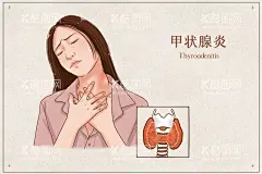 甲状腺炎  - 源文件下载【酷图网】漫画,疾病,指导图,健康,治疗,甲状腺炎,