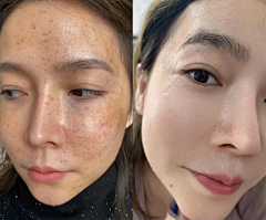 栗米采集到肌肤问题