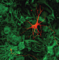 Cultured motor neuron (red) on a monolayer of astrocytes