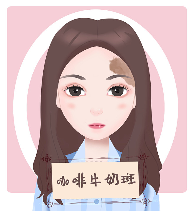 咖啡牛奶斑<br/>胎记，斑，痣，瘤，血...