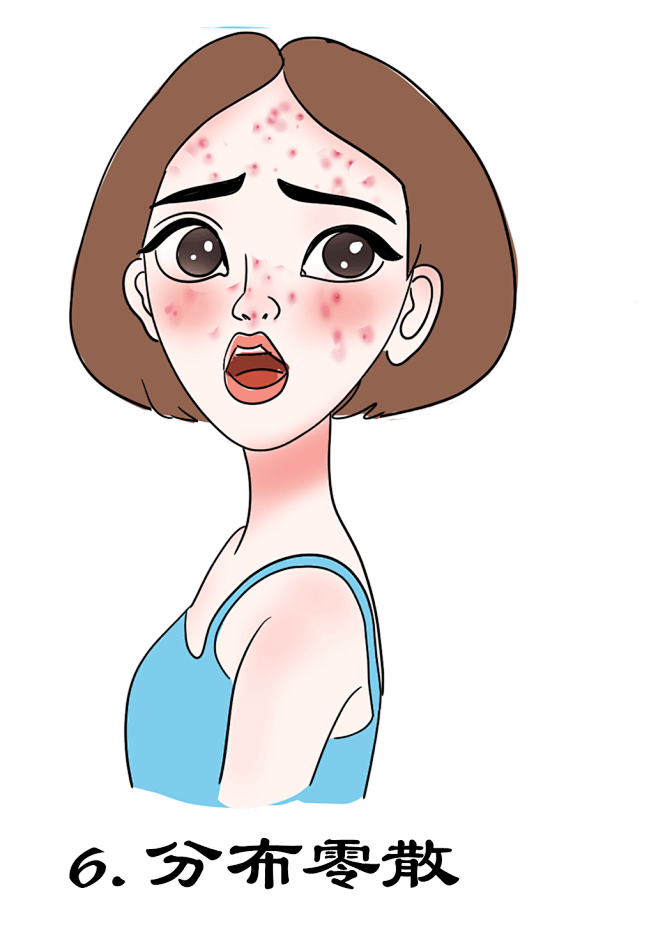 珑猫ミ从医美插画转采于2020-04-30 17:22:32白头粉刺 感染型痘痘