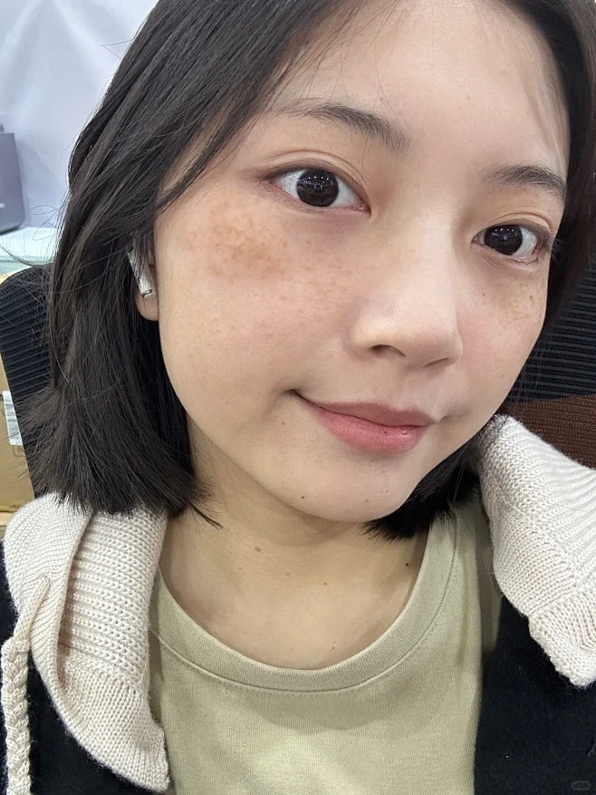 想告诉全世界！这法子祛斑真的优秀！！