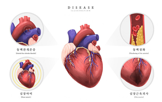 医院肌肉心脏动脉静脉研究医学疾病器官插画...