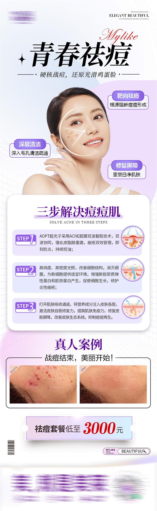 皮肤祛痘产品长图设计师皮肤祛痘产品长图