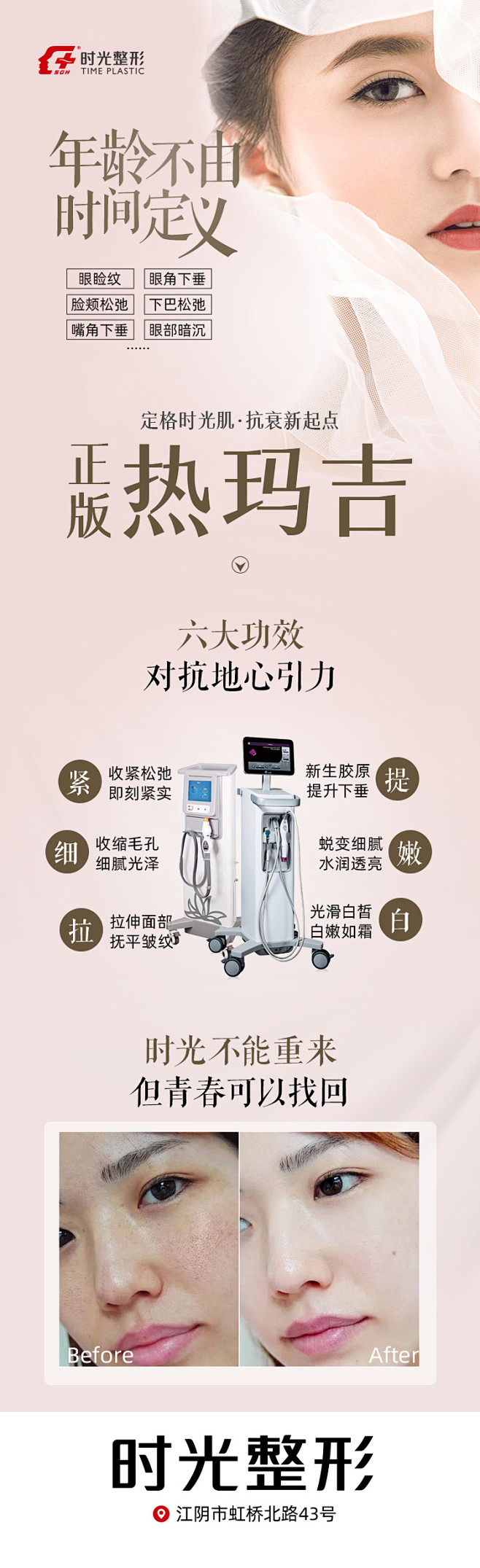第五代热玛吉---g1