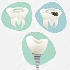 牙齿根部矢量图高清素材 免抠 设计图片 免费下载 页面网页 平面电商 创意素材 png素材