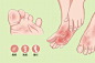 脚气