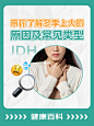 一篇全懂冬季上火的原因及常见类型❗️