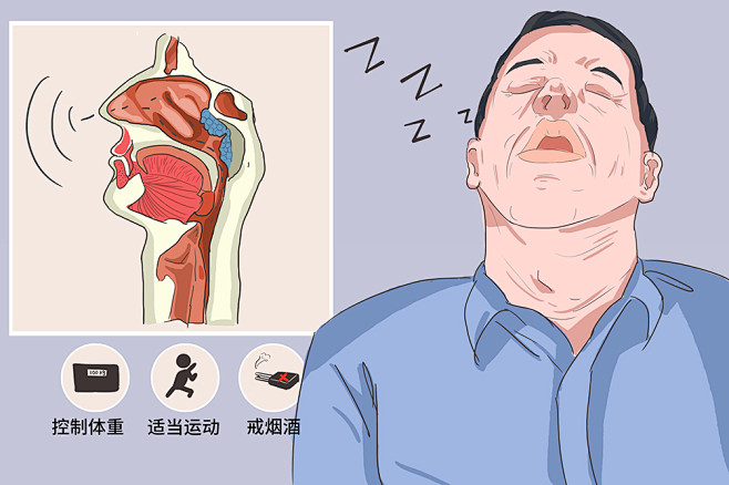 打鼾