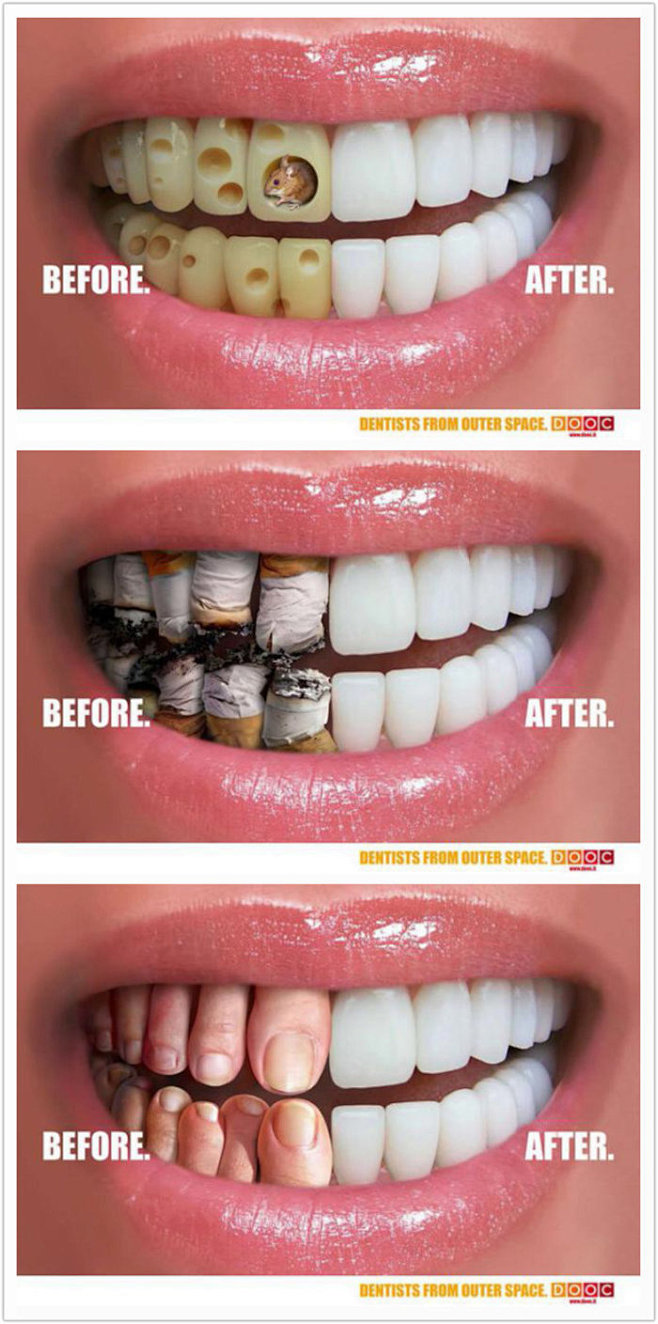 牙齿保护广告：比较重口味的一则平面广告。...
