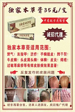 独家本草膏  - 源文件下载【酷图网】草膏,膏药,灰指甲,皮肤病,脚气,卢药师,独家本草膏,皮癣,湿疹,牛皮癣,头癣,体癣,屁眼,荨麻疹,皮肤病治疗,皮肤对比图,药膏海报,草药膏,本草膏药,中药配方,皮肤病海报,皮肤病广告,皮肤病展架,药膏代理