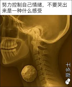 meme（梗图）图片大全-meme（梗图）高清好看的图片--花瓣超级无敌窝窝头的画板