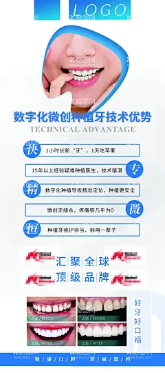 口腔展架   牙科海报   - 源文件下载【酷图网】口腔展架,牙科,牙科海报,牙科广告,牙科医院,牙科诊所,牙科X展架,牙优势,技术优势,牙齿,爱牙展架,展架,宣教展架,口腔宣教,爱牙宣教,牙科展架,口腔医院展架,蓝色展架,医院展架,牙齿防护,牙齿美白,100DPI