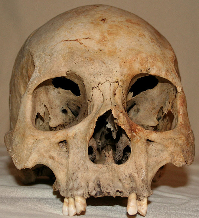 艺用解剖之人体多角度头骨姿态集40