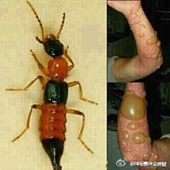 ayan采集到待归类采集