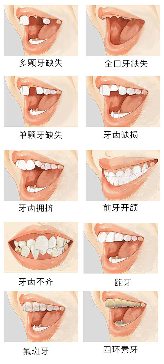 牙齿问题素材