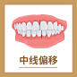 口腔问题 牙齿矫正
