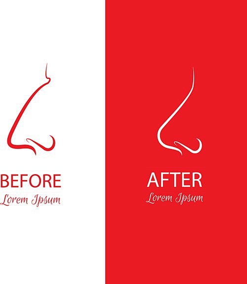 鼻子整形logo设计图片