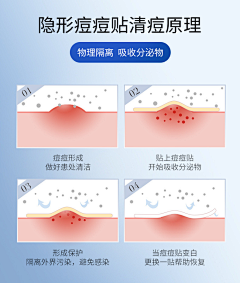 西西6160采集到痘痘相关