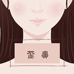 医美插画采集到医美鼻型,鼻型