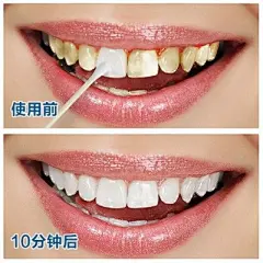 牙斑净牙齿美白去黄牙烟牙菌斑牙垢黑渍