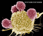 惊艳！25张超微镜界下令人震撼的癌细胞和癌细胞“斗士”！