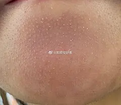@脸脸变好看 的个人主页 - 微博