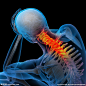 脊柱颈椎肌肉骨骼结构