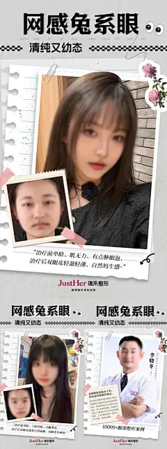 双眼皮案例对比海报-源文件分享-ywjfx.cn