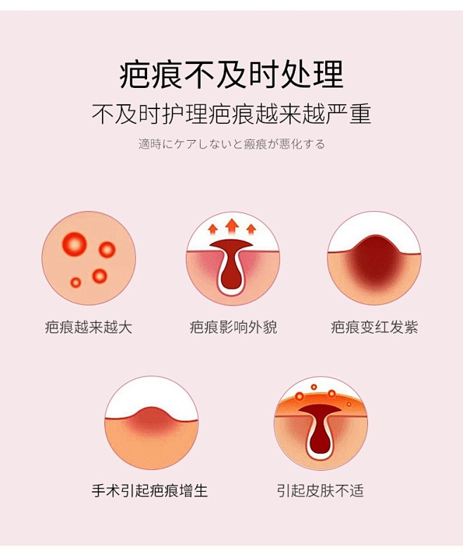 【日本品牌】DR.ROTUS御田医生祛疤膏医用疤痕增生去疤手术后修复淡化烧伤烫伤划痕双眼皮剖腹产 医用护创软膏1支装（体验装）【图片 价格 ...